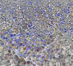 Microstructure effects on mechanical properties